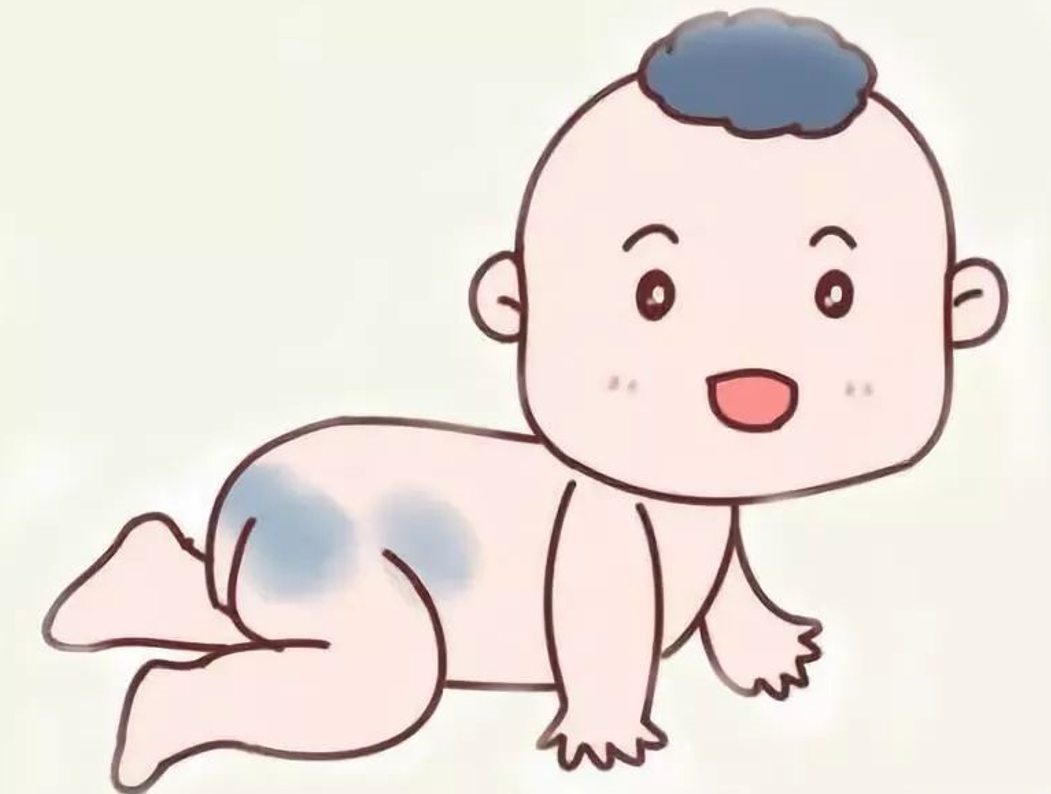 胎记的位置不好对命运有何影响